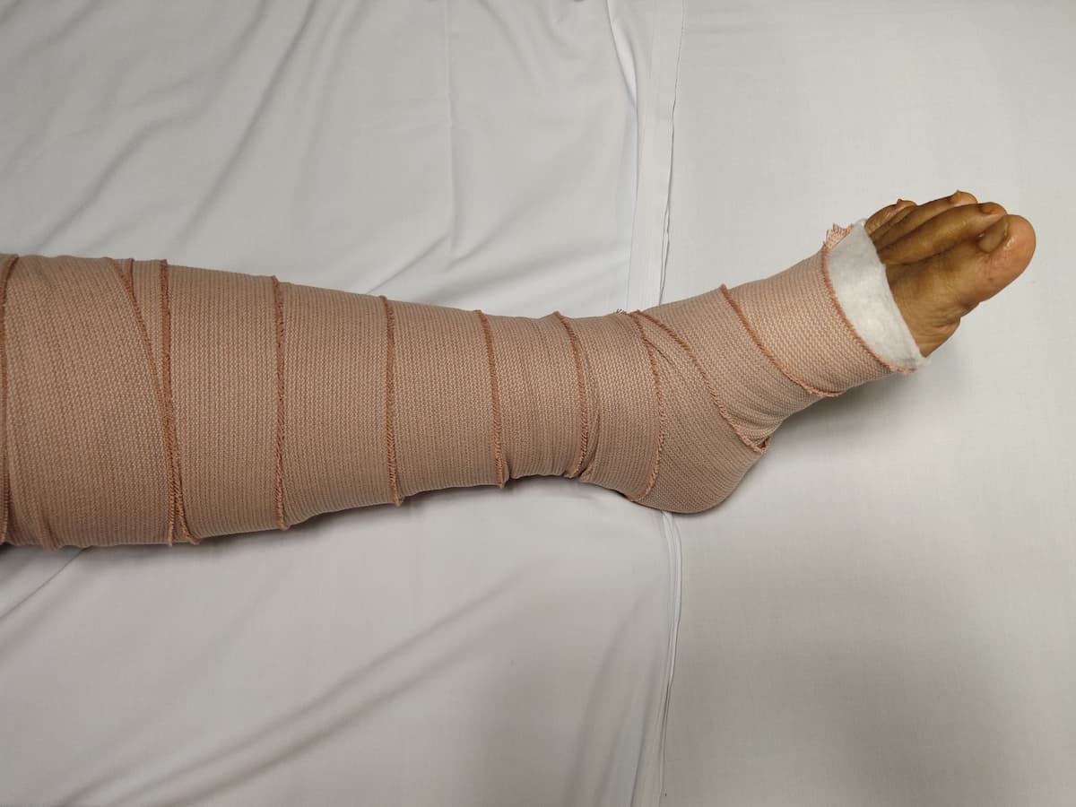 Compression Therapy - compression therapy benefits compression therapy benefits