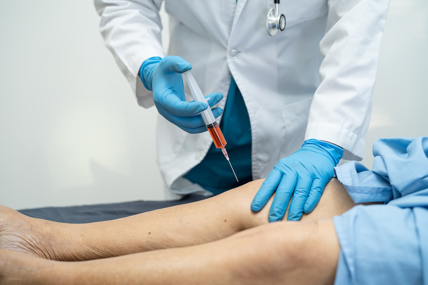 Sclerotherapy for Spider Veins Sclerotherapy for Spider Veins