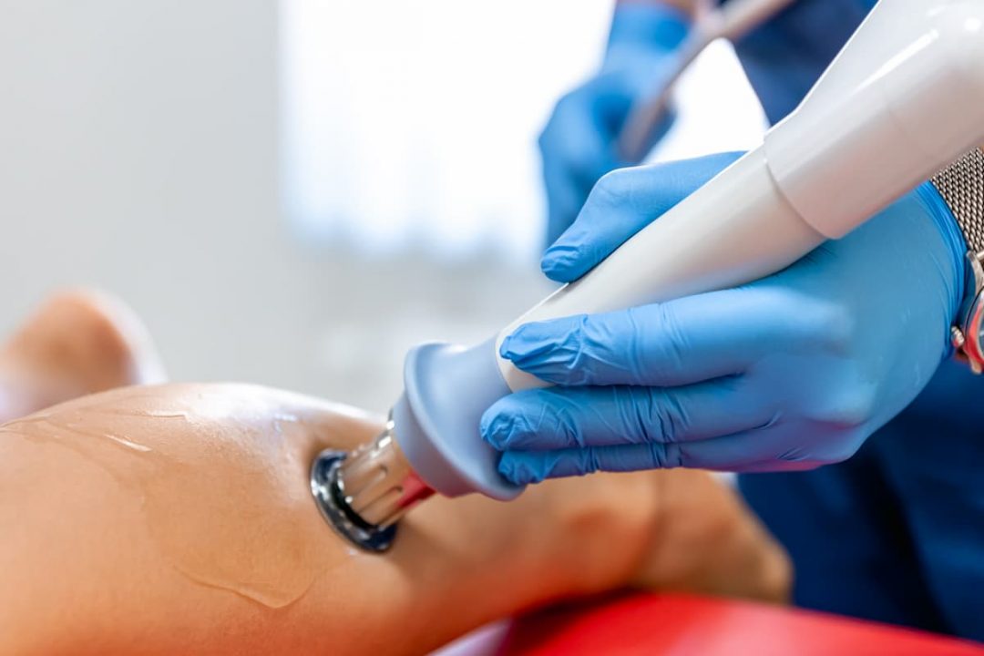 Radiofrequency Ablation (RFA)
