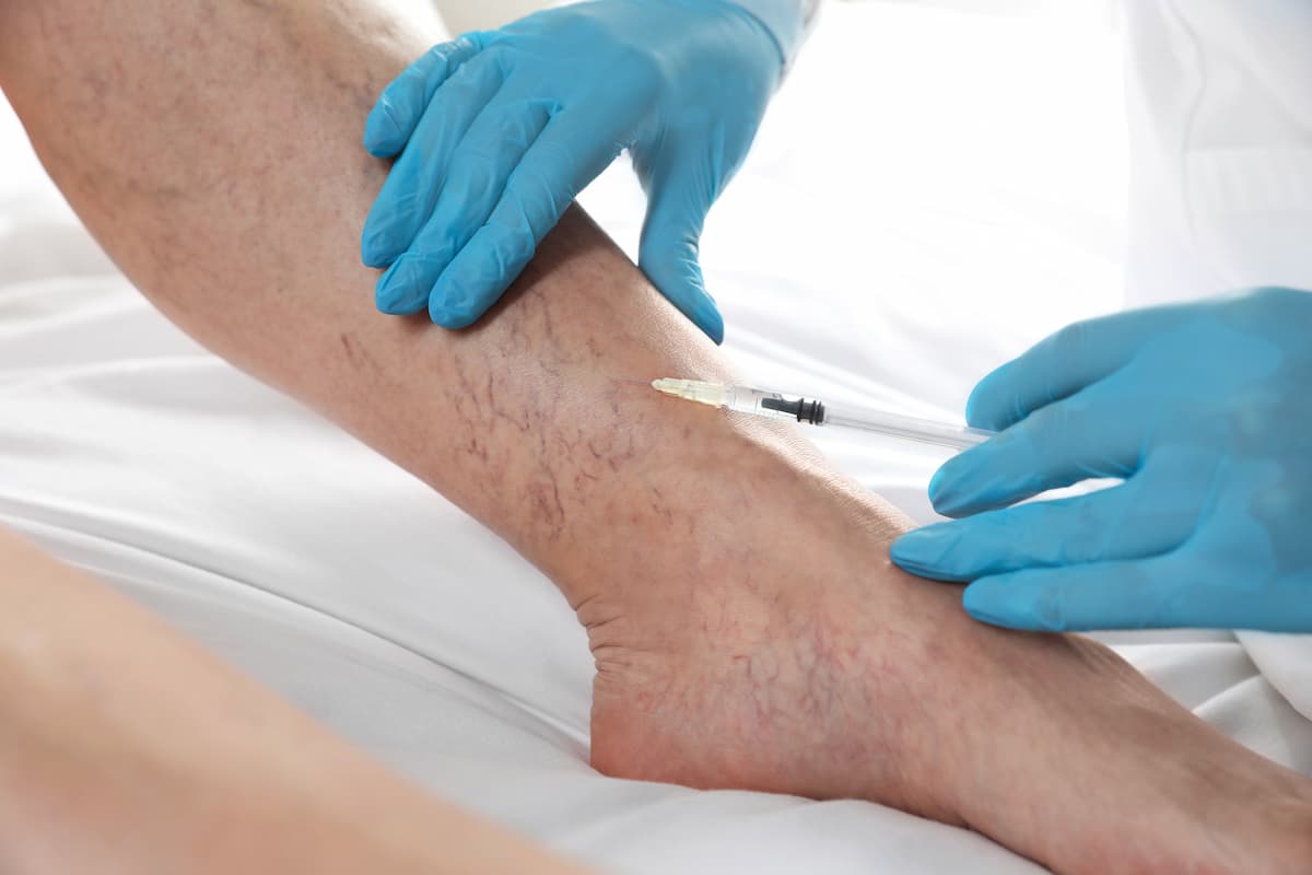 varicose-veins-treatment-doctor-giving-injection-patient-indoors-closeup-2-1.jpg